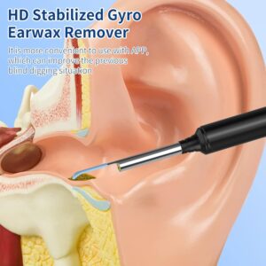 Ear Wax Removal Kit Ear Camera Digivel Stotre