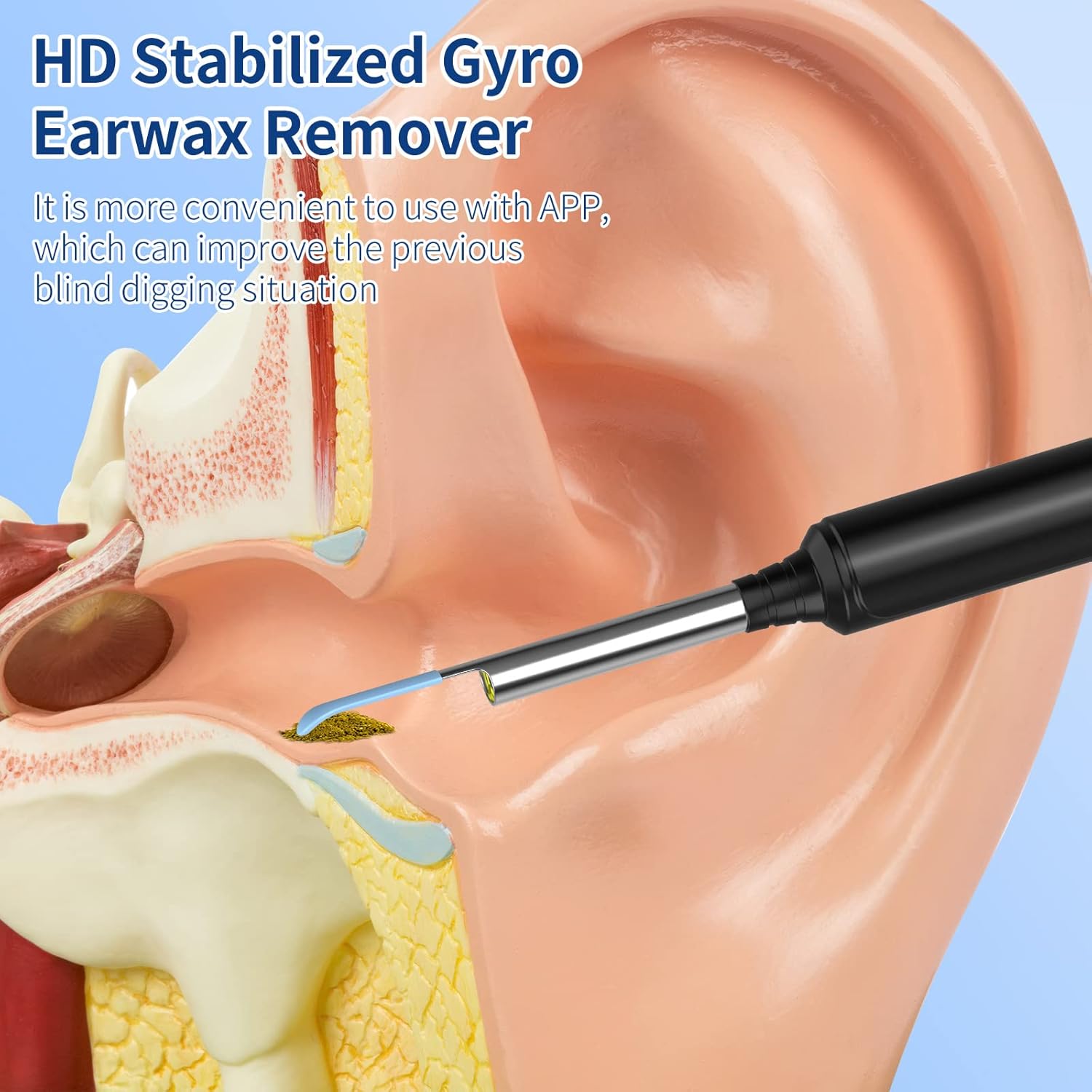 Ear Wax Removal Kit Ear Camera Digivel Stotre